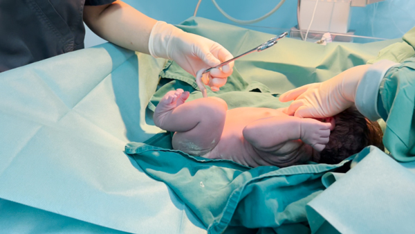 醫生為胎兒輸臍血。重慶安琪兒婦產醫院供圖