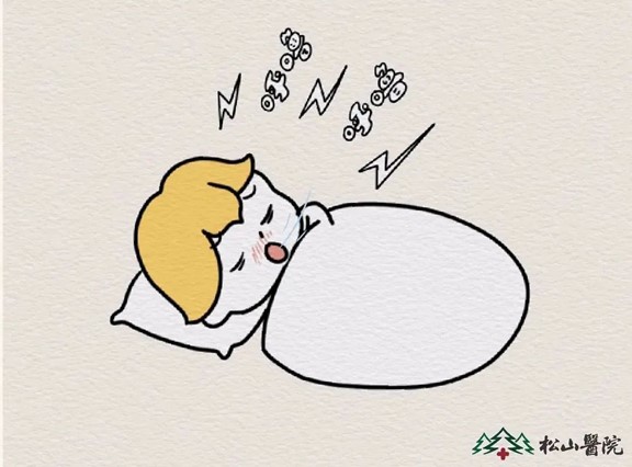 睡覺打鼾。重慶松山醫院供圖