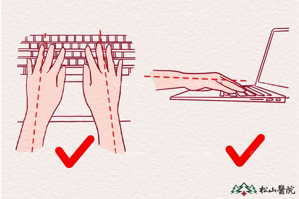 敲擊鍵盤的正確姿勢。重慶松山醫院供圖