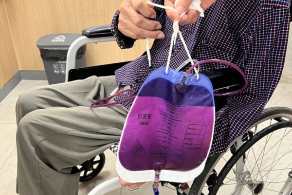 秦大爺出現“紫色尿液”。重慶西區醫院供圖