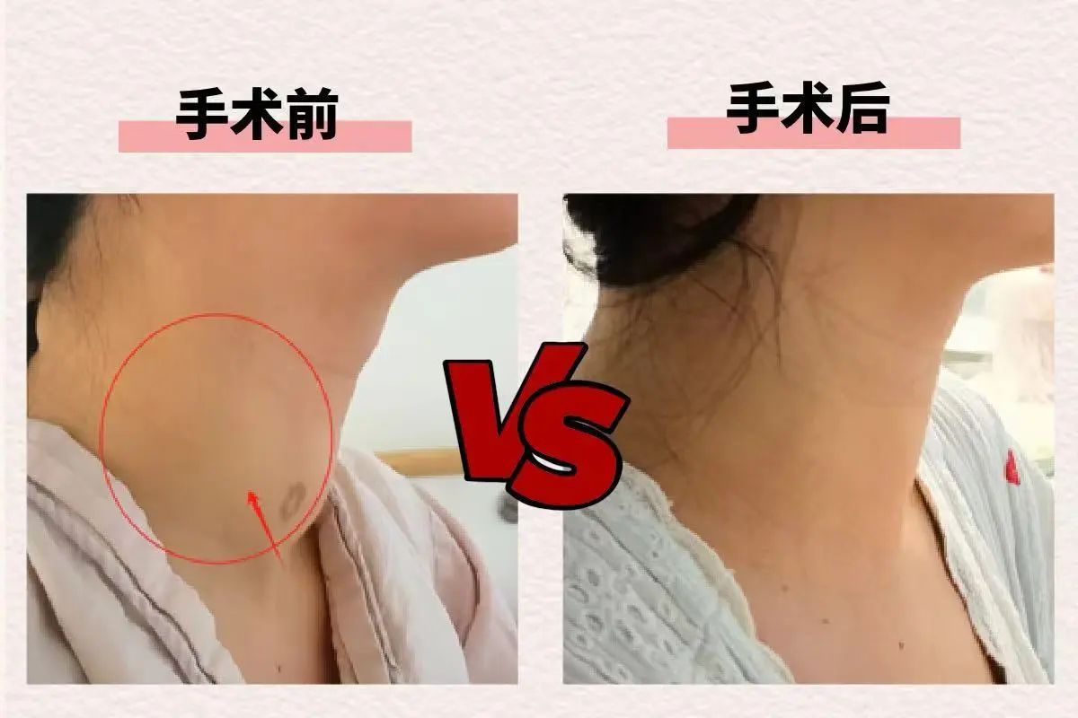 術后情況。重慶松山醫院供圖