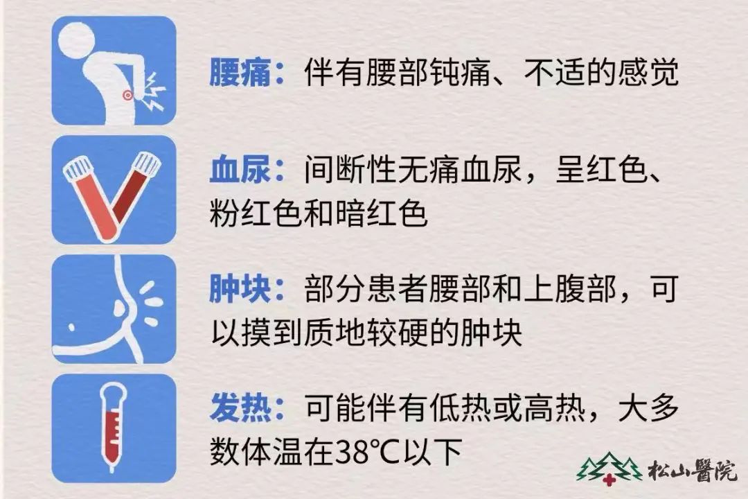 腎癌表現。重慶松山醫院供圖