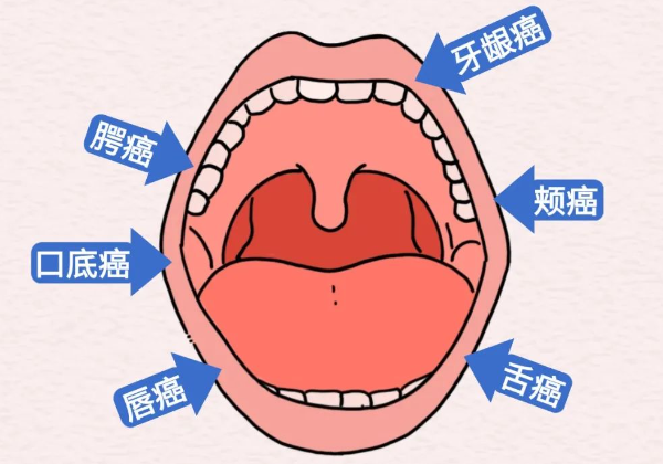 示意圖。重慶松山意圖供圖