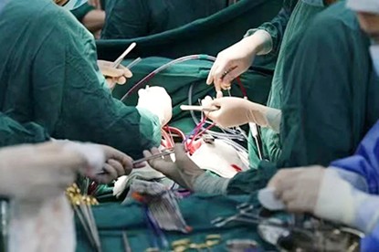 手術現場。重慶西區醫院供圖