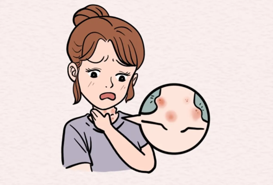 示意圖。重慶松山醫院供圖