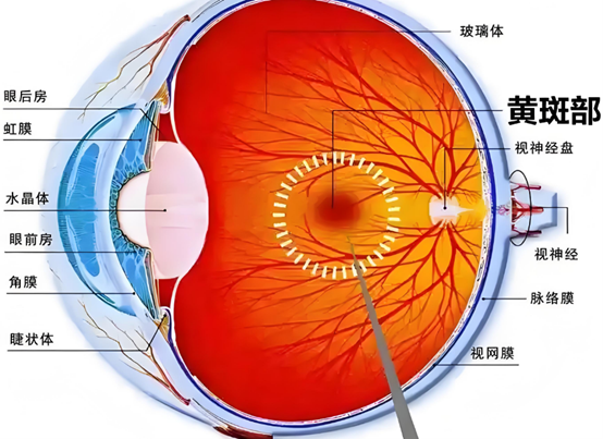 黃斑部。重慶普瑞眼科醫院供圖